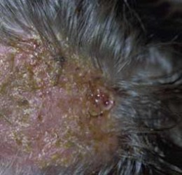 bumps on the scalp - tinea capitis
